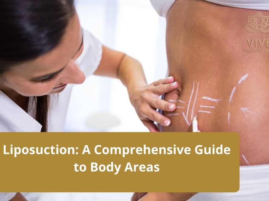 A doctor marking a patient's abdomen with white lines, indicating targeted areas for liposuction and body contouring.