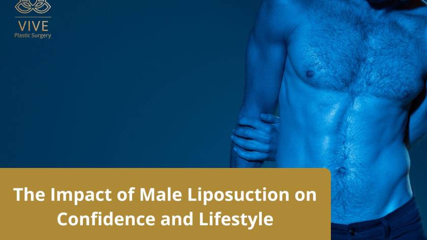 Male Liposuction Before and After – Confidence Boosting Body Contouring | VIVE Plastic Surgery