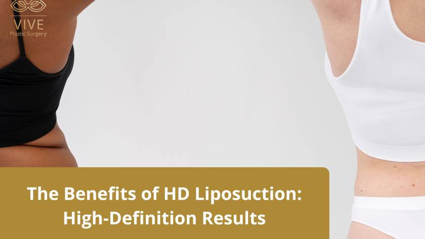 HD Liposuction Before and After – High-Definition Body Contouring | VIVE Plastic Surgery