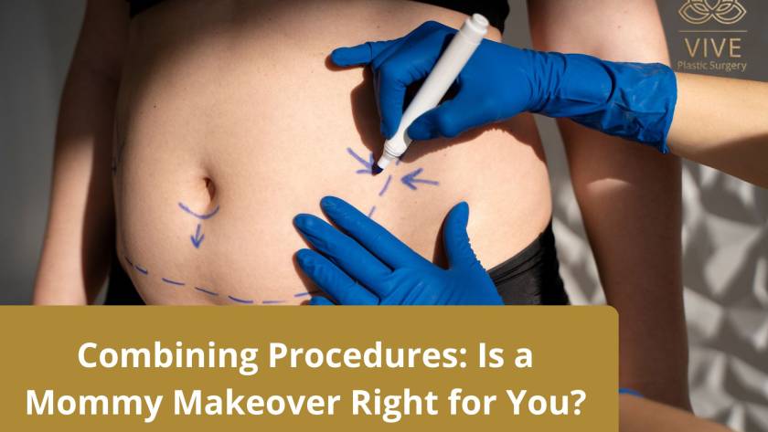 Mommy Makeover Procedure - Is It Right for You? | VIVE Plastic Surgery
