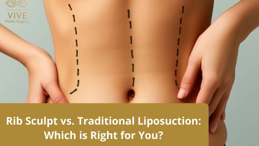Rib Sculpting vs. Traditional Liposuction - Which is Best for You? | VIVE Plastic Surgery