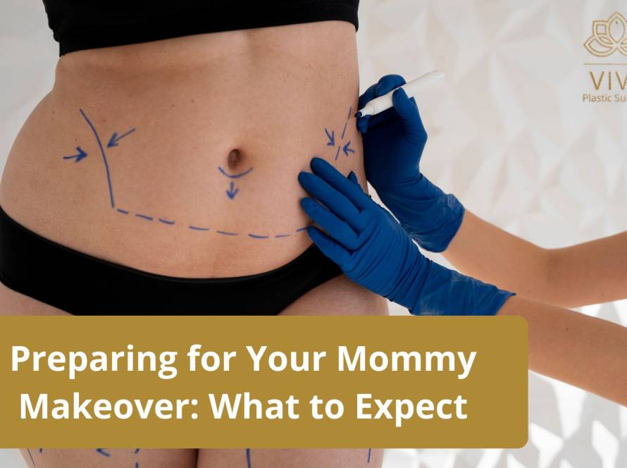 Mommy Makeover Surgery - What to Expect & How to Prepare | VIVE Plastic Surgery Tijuana