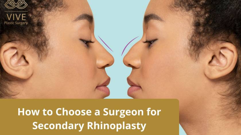 Secondary Rhinoplasty in Tijuana - Expert revision nose surgery at VIVE Plastic Surgery.
