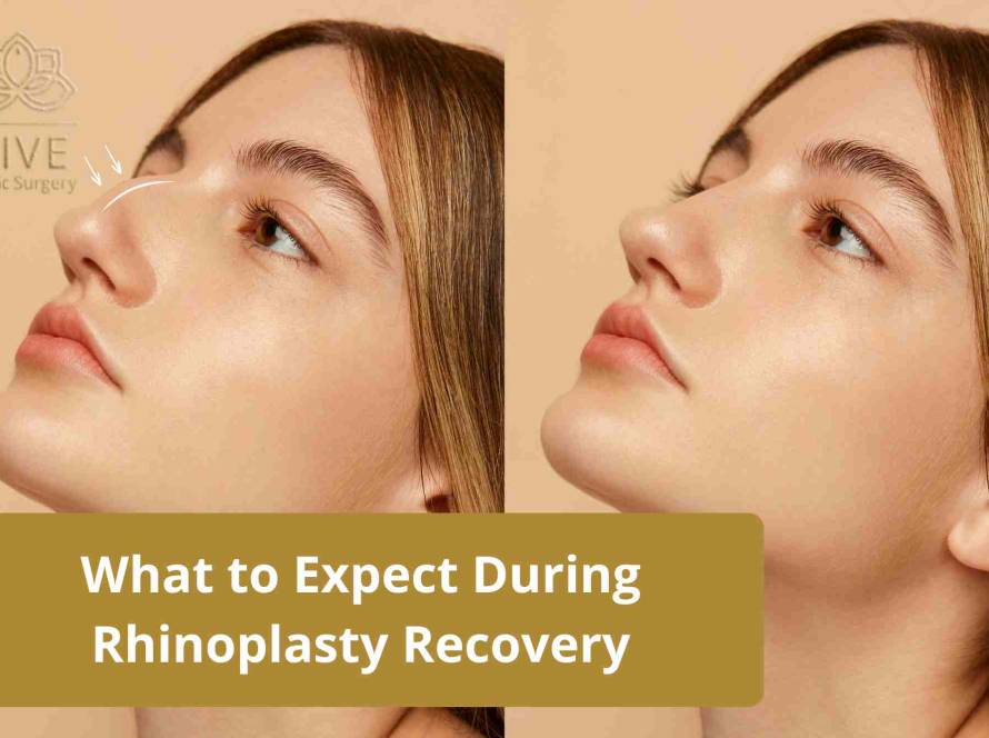 Before and after rhinoplasty recovery showcasing nose reshaping results at Vive Plastic Surgery, Tijuana.
