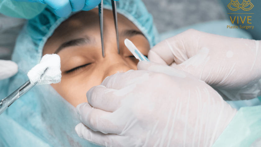 Close-up of a reconstructive rhinoplasty procedure at VIVE Plastic Surgery, specializing in Botox, lip fillers, and advanced butt fillers in Tijuana.
