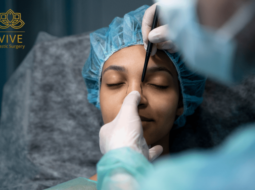 Woman undergoing rhinoplasty preparation with surgical markings in Tijuana