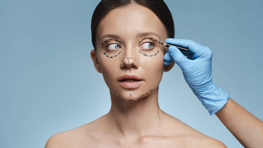 Woman with face marked before plastic surgery consultation in Tijuana