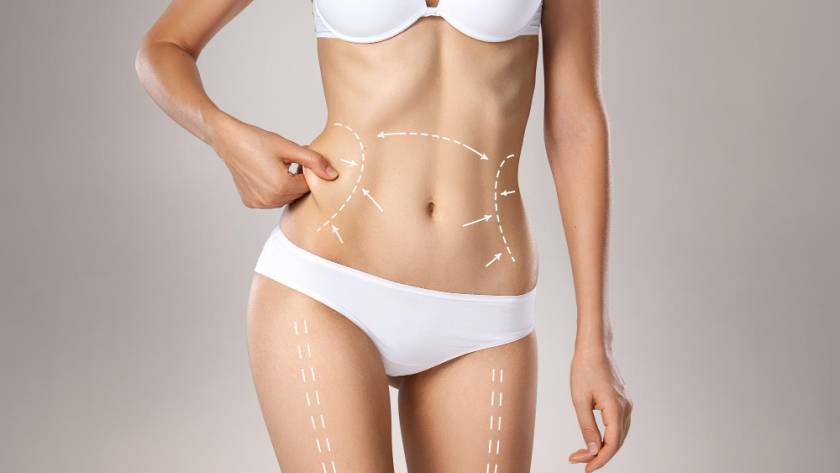 Woman showing body contouring areas for liposuction and tummy tuck in Tijuana