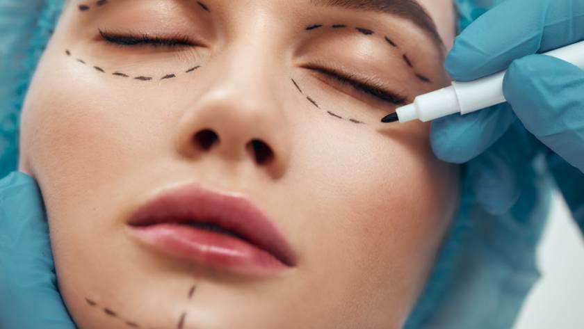 Surgeon marking face before eyelid and facelift surgery in Tijuana