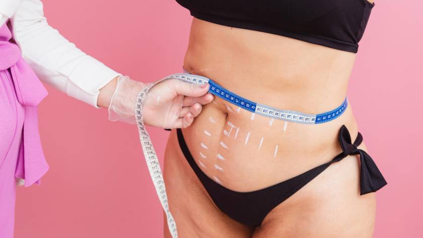 Woman measuring waist before liposuction surgery in Tijuana